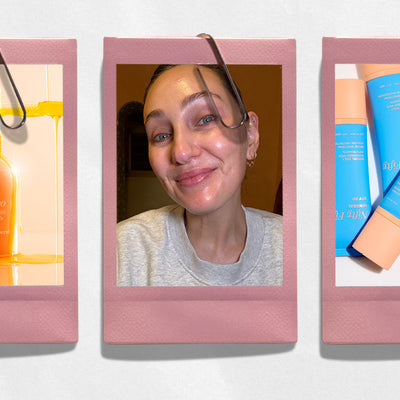 Zoë’s 4-Step Post-Treatment AM Routine