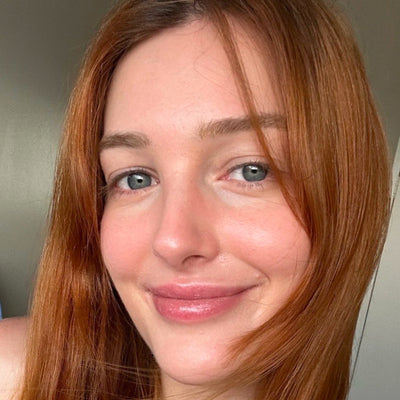 I’m On Roaccutane In My Thirties—Here’s How I Protect My Skin