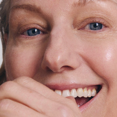 What Are Age Spots (And What To Do About Them)