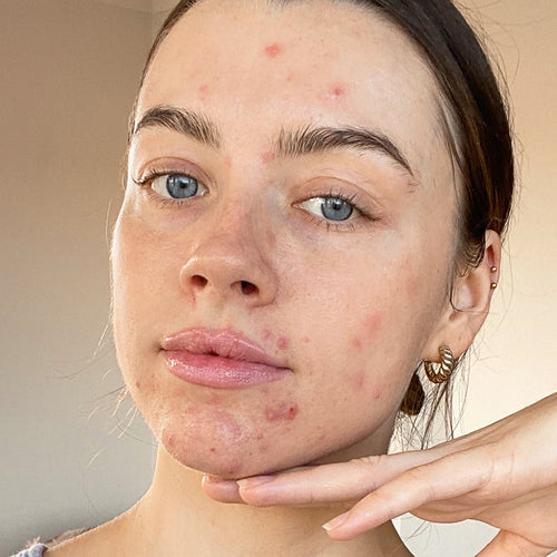 Maddie Edwards on Ditching Filters and Embracing Her Skin