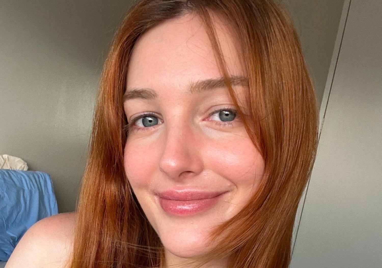 I’m On Roaccutane In My Thirties—Here’s How I Protect My Skin