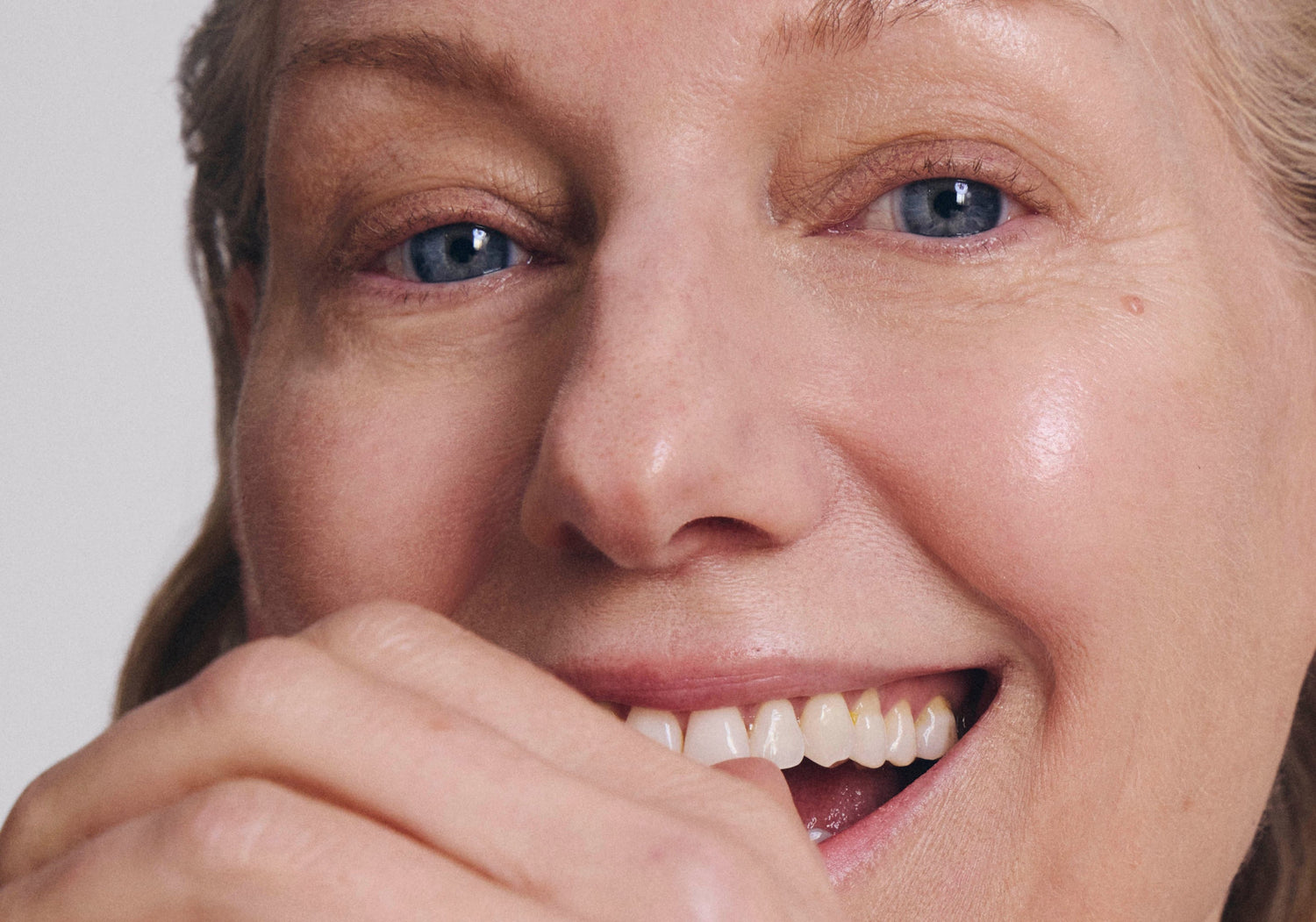 What Are Age Spots (And What To Do About Them)