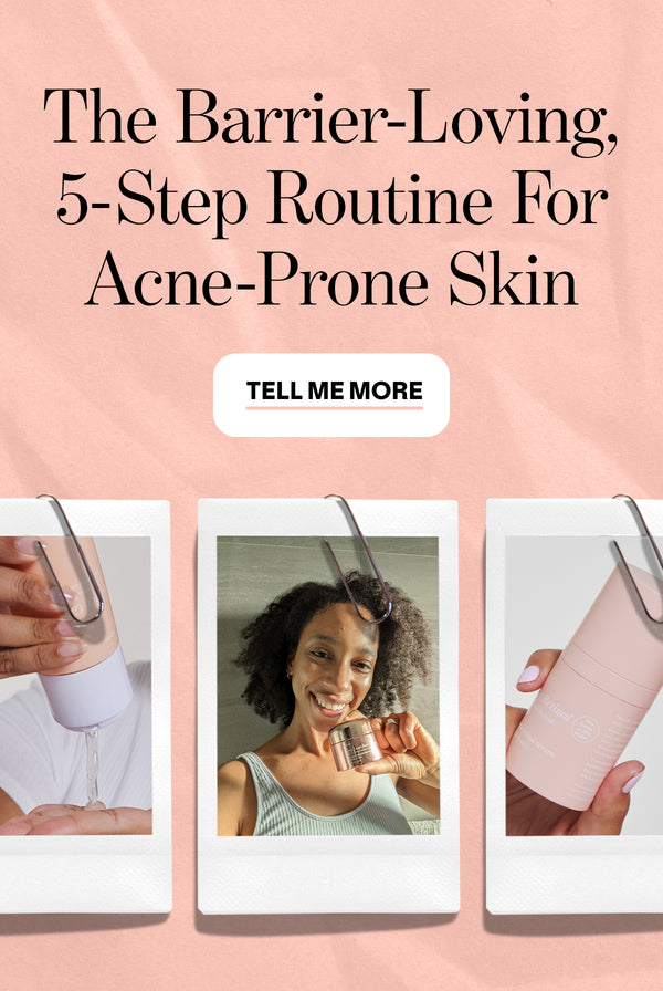 A skincare ad with the headline The Barrier-Loving, 5-Step Routine For Acne-Prone Skin. Below are three Polaroid-style photos: someone dispensing product, a smiling woman holding skincare, and a hand holding a skincare bottle.
