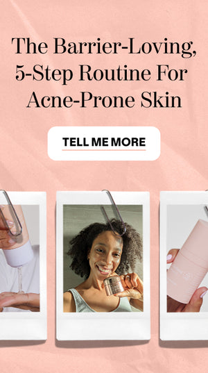 Promotional image for a 5-step skincare routine for acne-prone skin. Text reads, The Barrier-Loving, 5-Step Routine For Acne-Prone Skin. Below are Polaroid photos of people holding skincare products. A Tell Me More button is centered.